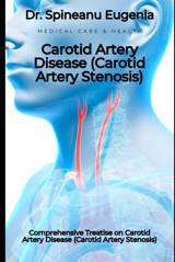 Comprehensive Treatise On Carotid Artery Disease (Carotid Artery Stenosis) (Medical Care And Health) Eugenia, Dr. Spineanu Independently Publıshed