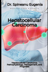 Hepatocellular Carcinoma: Pathophysiology, Management, And Prognosis Eugenia, Dr. Spineanu Independently Publıshed