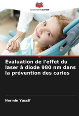 Valuation De L'Effet Du Laser Diode 980 Nm Dans La Prvention Des Caries Yussif, Nermin Editions Notre Savoir