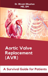 Aortic Valve Replacement (Avr): A Survival Guide For Patients Bhushan, Dr. Bhratri Independently Publıshed