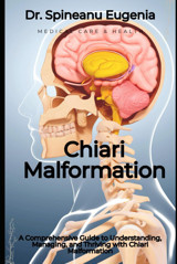 A Comprehensive Guide To Understanding, Managing, And Thriving With Chiari Malformation Eugenia, Dr. Spineanu Independently Publıshed