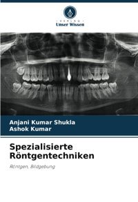 Spezialisierte Röntgentechniken: Röntgen, Bildgebung Shukla, Anjani Kumar Verlag Unser Wissen