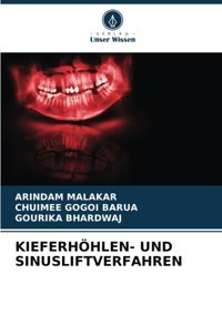 Kıeferhöhlenund Sınuslıftverfahren Malakar, Arindam Verlag Unser Wissen