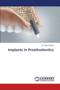 Implants İn Prosthodontics: De Dhami, Dr. Rahul Lap Lambert Academic Publishing