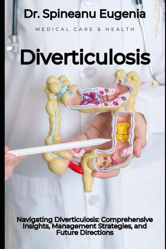 Navigating Diverticulosis: Comprehensive Insights, Management Strategies, And Future Directions Eugenia, Dr. Spineanu Independently Publıshed