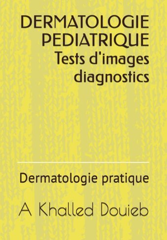 Dermatologıe Pedıatrıque Tests D'İmages Diagnostics: Dermatologie Pratique (French Edition) Douieb, A Khalled Independently Publıshed