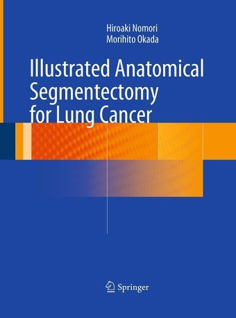 Illustrated Anatomical Segmentectomy For Lung Cancer Nomori, Hiroaki Springer