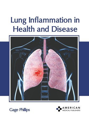 Lung Inflammation İn Health And Disease American Medical Publishers