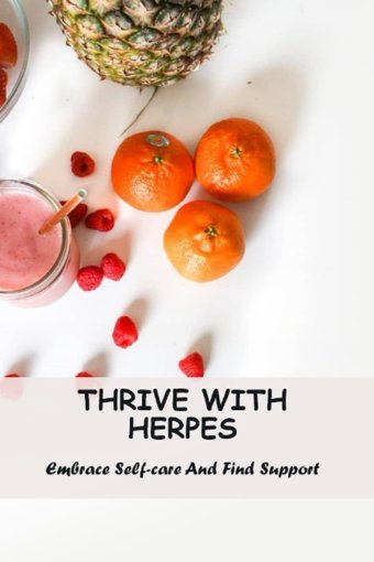 Thrive With Herpes: Embrace Self-Care And Find Support Clemenza, Petrina Independently Publıshed