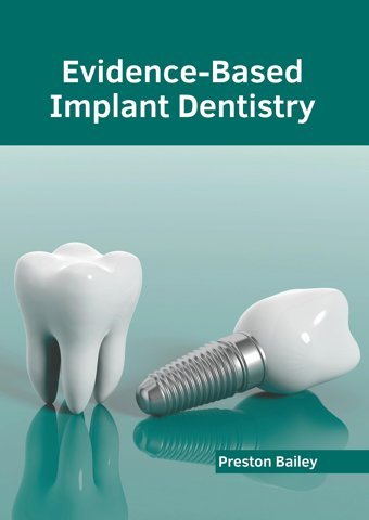 Evidence-Based Implant Dentistry American Medical Publishers