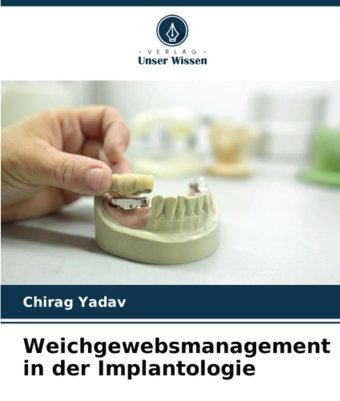 Weichgewebsmanagement İn Der Implantologie Yadav, Chirag Verlag Unser Wissen