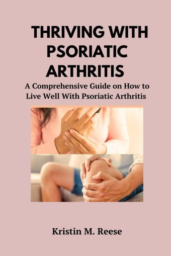 Thrıvıng Wıth Psorıatıc Arthrıtıs: A Comprehensive Guide On How To Live Well With Psoriatic Arthritis Reese, Kristin M. Independently Publıshed