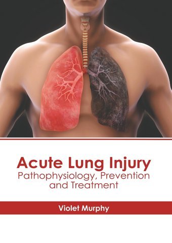 Acute Lung Injury: Pathophysiology, Prevention And Treatment American Medical Publishers