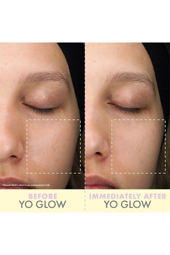 Wishful Yo Glow Jel Tüp Yüz Peelingi 100 ml