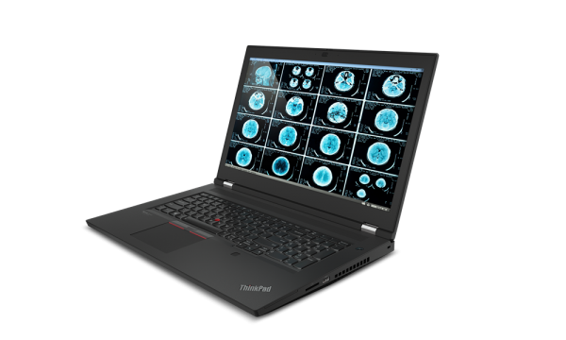 Lenovo ThinkPad P17 G2 20YU001XTX11 Harici RTX A2000 Ekran Kartlı Intel Core i7 11800H 64 GB Ram DDR4 2 TB SSD 17.3 inç FHD Windows 10 Pro Laptop