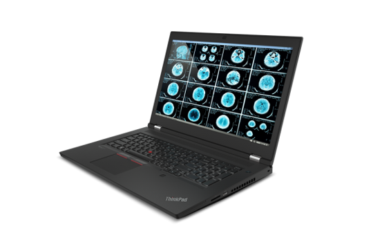 Lenovo ThinkPad P17 G2 20YU001XTX Harici RTX A2000 Ekran Kartlı Intel Core i7 11800H 16 GB Ram DDR4 512 GB SSD 17.3 inç FHD Windows 10 Pro Laptop